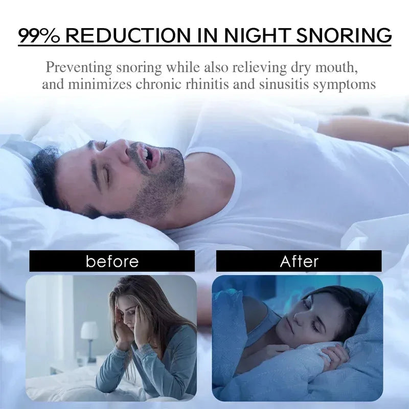 30Pcs Anti-Snoring Mouth Patch, Sleep Tape to Close Mouth Patch, Improve Sleep, Prevent Open Mouth Patch